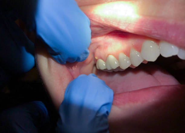 Best Urgent Tooth Repair  in Mayfield, OH